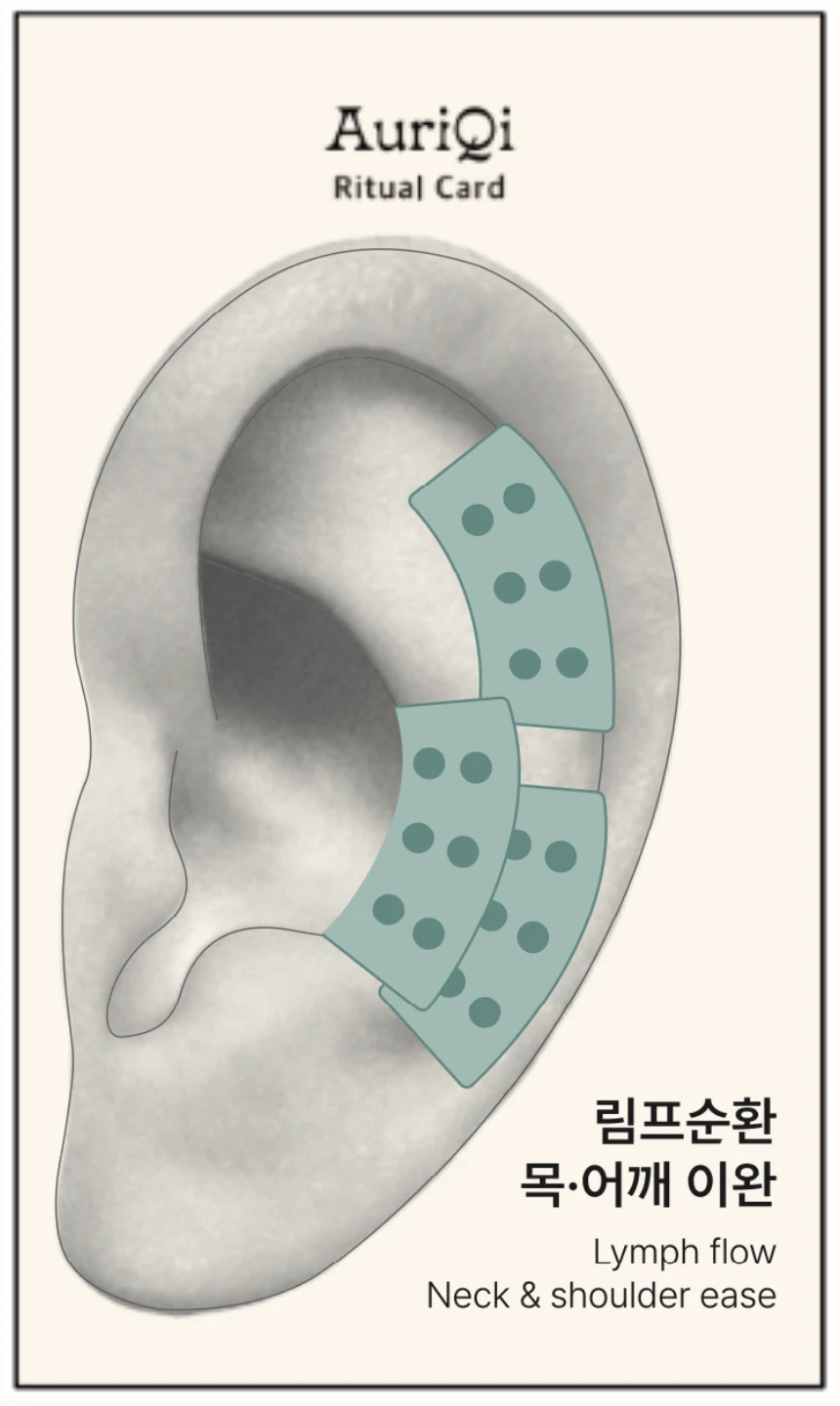 기본자리 시술 영역 — 오리키이어시드 리추얼 카드